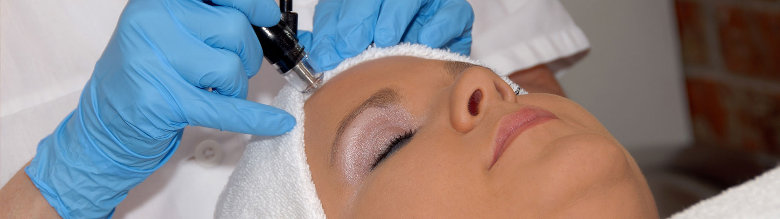 face laser treatment