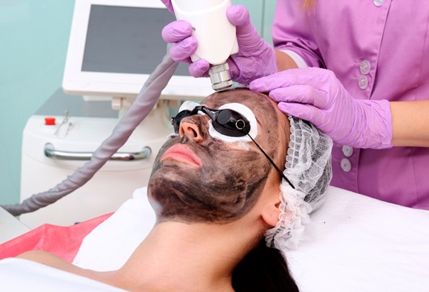 Afbeelding Carbon Laser Peeling