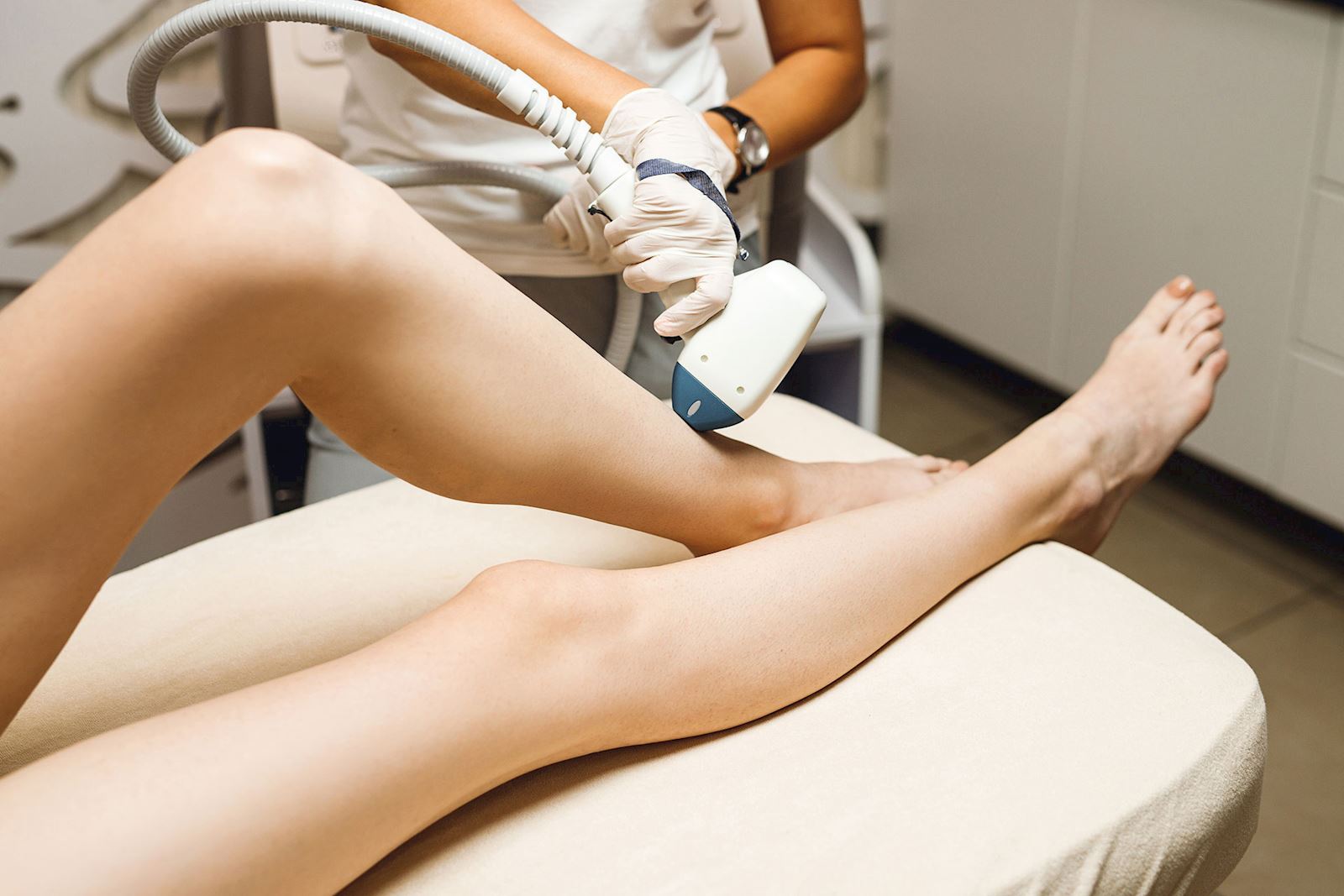 stockfoto laser ontharing