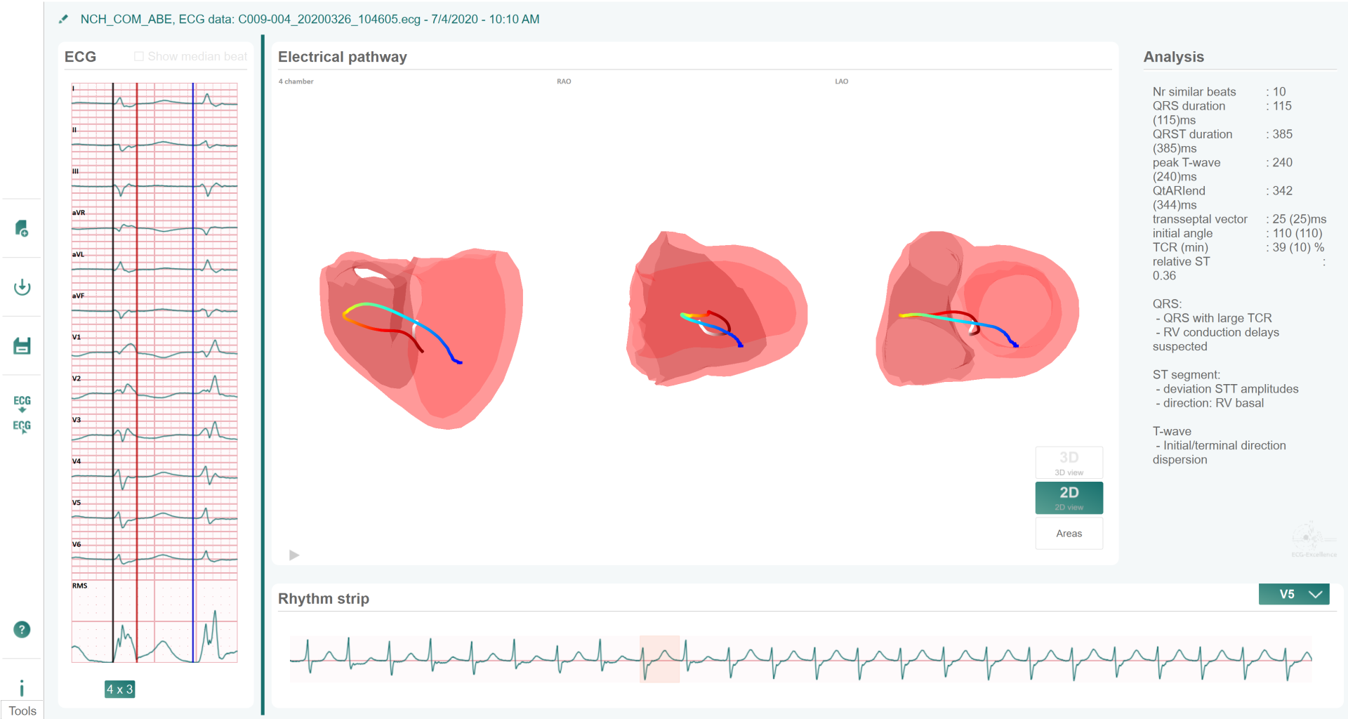 CIVID example