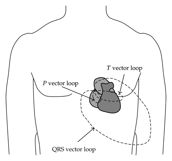 vectorcardiology 4